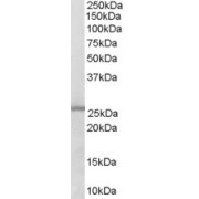 abx430539 (0.3 µg/ml) staining of Human Lung lysate (35 µg protein in RIPA buffer). Primary incubation was 1 hour. Detected by chemiluminescence.