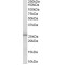 Glutathione S Transferase Mu 1 (GSTM1) Antibody