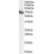 Huntingtin-Interacting Protein 14 (HIP14) Antibody