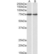 abx430544 (1 µg/ml) staining of HepG2 (A) and MCF7 (B) lysates (35 µg protein in RIPA buffer). Detected by chemiluminescence.