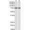 Endoplasmic Reticulum Chaperone BiP (HSPA5) Antibody