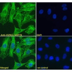 Endoplasmic Reticulum Chaperone BiP (HSPA5) Antibody
