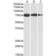 abx430545 (0.1 µg/ml) staining of HepG2 (A), HeLa (B) and MCF7 (C) cell lysate (35 µg protein in RIPA buffer). Detected by chemiluminescence.