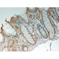 Interleukin 12B (IL12B) Antibody