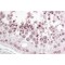 InaD-Like Protein (INADL) Antibody