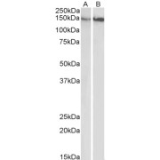 abx430552
