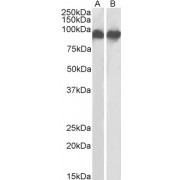 abx430553 (0.3 µg/ml) staining of K562 (A) and U937 (B) lysates (35 µg protein in RIPA buffer). Primary incubation was 1 hour. Detected by chemiluminescence.