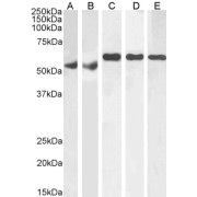 abx430556 (1 µg/ml) staining of Human Testes (A), Human Ovary (B), Mouse Testes (C), Rat Testes (D) and Rat Ovary (E) lysate (RIPA buffer, 35 µg total protein per lane). Detected by chemiluminescence.