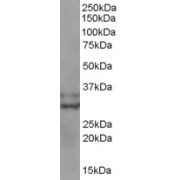 abx430558 staining (0.3 µg/ml) of MOLT4 lysate (35 µg protein in RIPA buffer). Primary incubation was 1 hour. Detected by chemiluminescence.