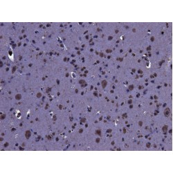Leucine-Rich Repeat Serine/Threonine-Protein Kinase 2 (LRRK2) Antibody