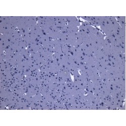 Leucine-Rich Repeat Serine/Threonine-Protein Kinase 2 (LRRK2) Antibody