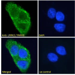 Leucine-Rich Repeat Serine/Threonine-Protein Kinase 2 (LRRK2) Antibody