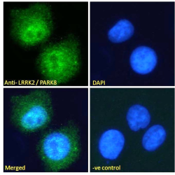 Leucine-Rich Repeat Serine/Threonine-Protein Kinase 2 (LRRK2) Antibody