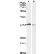 abx430561 staining (1 µg/ml) of A549 (A) and PD19 (B) cell lysate (RIPA buffer, 30 µg total protein per lane). Detected by chemiluminescence.