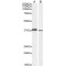 Melanoma Nuclear Protein 18 (MEL18) Antibody