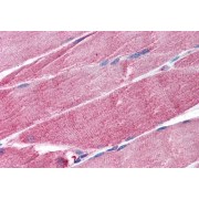 abx430564 (1.25 µg/ml staining of paraffin embedded Human Skeletal Muscle. Steamed antigen retrieval with citrate buffer pH 6, AP-staining.