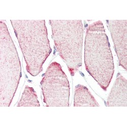 Muscle-Specific RING Finger Protein 3 (MURF3) Antibody