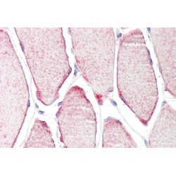 Muscle-Specific RING Finger Protein 3 (MURF3) Antibody