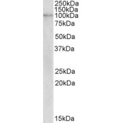 abx430572 (2 µg/ml) staining of Human Breast cancer lysate (35 µg protein in RIPA buffer). Primary incubation was 1 hour. Detected by chemiluminescence.