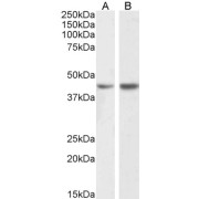 abx430573 (1 µg/ml) staining of Human (A) and Mouse (B) Kidney lysate (35 µg protein in RIPA buffer). Detected by chemiluminescence.