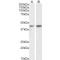 Podocin / PDCN (NPHS2) Antibody