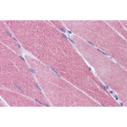 Old Astrocyte Specifically-Induced Substance (OASIS) Antibody