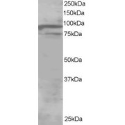 abx430576 staining (1 µg/ml) of Human Brain lysate (RIPA buffer, 30 µg total protein per lane). Primary incubated for 1 hour. Detected by western blot using chemiluminescence.