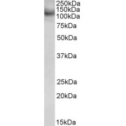 abx430595 (0.5 µg/ml) staining of JURKAT lysate (35 µg protein in RIPA buffer). Primary incubation was 1 hour. Detected by chemiluminescence.