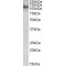E3 Ubiquitin-Protein Ligase RNF31 (RNF31) Antibody