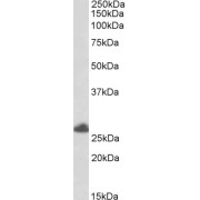 abx430596 (0.5 µg/ml) staining of Human Placenta lysate (35 µg protein in RIPA buffer). Primary incubation was 1 hour. Detected by chemiluminescence.