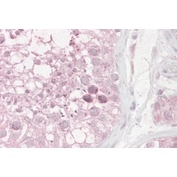 RING Finger Protein 36 (RNF36) Antibody