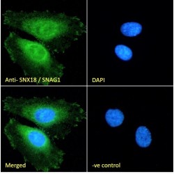 Sorting Nexin 18 (SNX18) Antibody