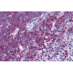 Stathmin 1 (STMN1) Antibody