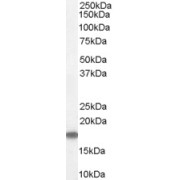 abx430609 (1 µg/ml) staining of Human Testis Lysate (35 µg protein in RIPA buffer). Primary incubation was 1 hour. Detected by chemiluminescence.