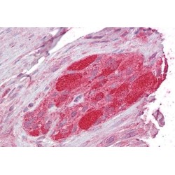 STIP1 Homology And U-Box Containing Protein 1 (STUB1) Antibody