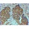 Transcription Intermediary Factor 1-Alpha (TIF1A) Antibody