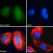 abx430618 Immunofluorescence analysis of paraformaldehyde fixed U2OS cells, permeabilized with 0.15% Triton. Primary incubation 1hr (10 µg/ml) followed by AF488 secondary antibody (2 µg/ml), showing nuclear staining. Actin filaments were stained with phalloidin (red) and the nuclear stain is DAPI (blue). Negative control: Unimmunized goat IgG (10 µg/ml) followed by AF488 secondary antibody (2 µg/ml).