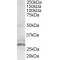 Oxidoreductase HTATIP2 (HTATIP2) Antibody