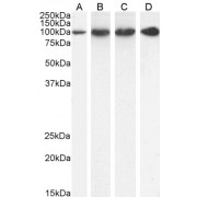 abx430621 (1 µg/ml) staining of HeLa (A), U251 (B), KNRK (C) and (0.3 µg/ml) NIH3T3 (D) cell lysate (35 µg protein in RIPA buffer). Detected by chemiluminescence.