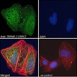 Transient Receptor Potential Cation Channel Subfamily M Member 7 (TRPM7) Antibody