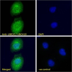 Ubiquitin Conjugating Enzyme E2C (UBE2C) Antibody