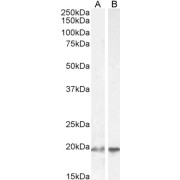 abx430628 (2 µg/ml) staining of HEK293 (A) and HeLa (B) cell lysate (35 µg protein in RIPA buffer). Detected by chemiluminescence.