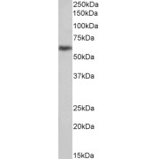 abx430629 (1 µg/ml) staining of U251 lysate (35 µg protein in RIPA buffer). Primary incubation was 1 hour. Detected by chemiluminescence.