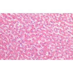 NADH-Cytochrome B5 Reductase 3 (CYB5R3) Antibody