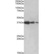 abx430637 (0.5 µg/ml) staining of Human Liver lysate (lane 1), Mouse Liver (lane 2) and Rat Liver (lane 3) (35 µg protein in RIPA buffer). Detected by chemiluminescence.