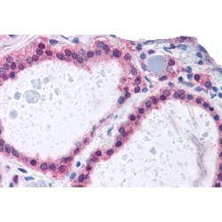 ADAM Metallopeptidase Domain 17 (ADAM17) Antibody