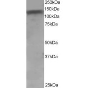 abx430638