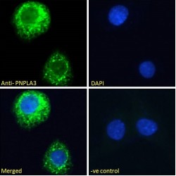 Patatin Like Phospholipase Domain Containing Protein 3 (PNPLA3) Antibody