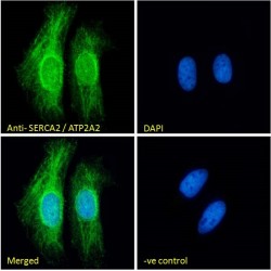 Sarcoplasmic/Endoplasmic Reticulum Calcium ATPase 2 (ATP2A2) Antibody