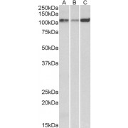 Western blot analysis of Human (A), Mouse (B) and Rat (C) Heart lysates (35 µg protein in RIPA buffer) using ATP2A2 antibody (0.1 µg/ml).